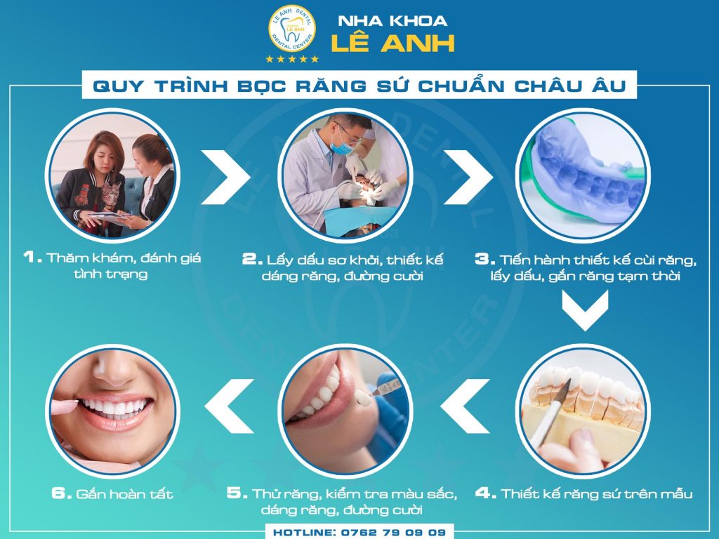 Răng Sứ Thẩm Mỹ 04 - Quy Trình Thực Hiện