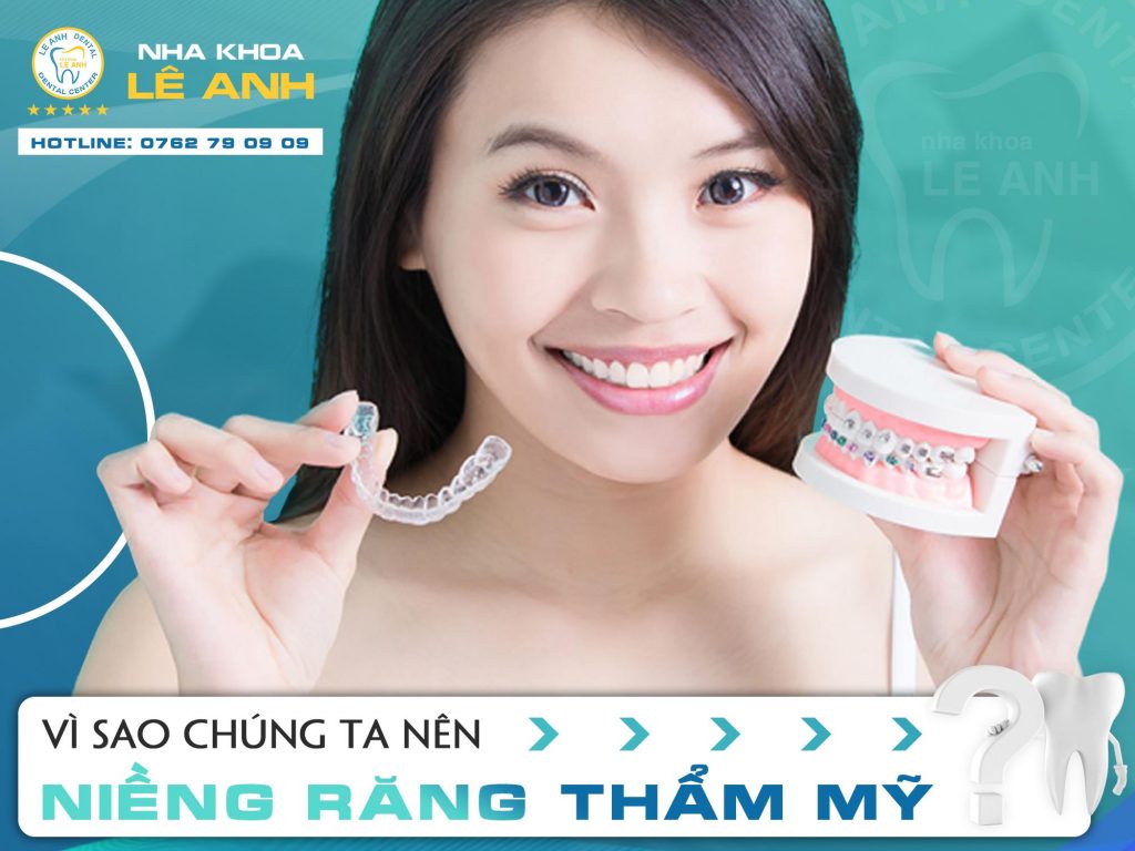 niềng răng thẩm mỹ