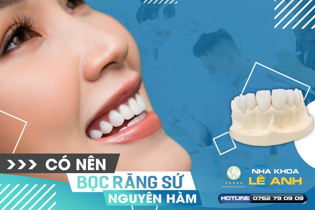 bọc răng sứ nguyên hàm