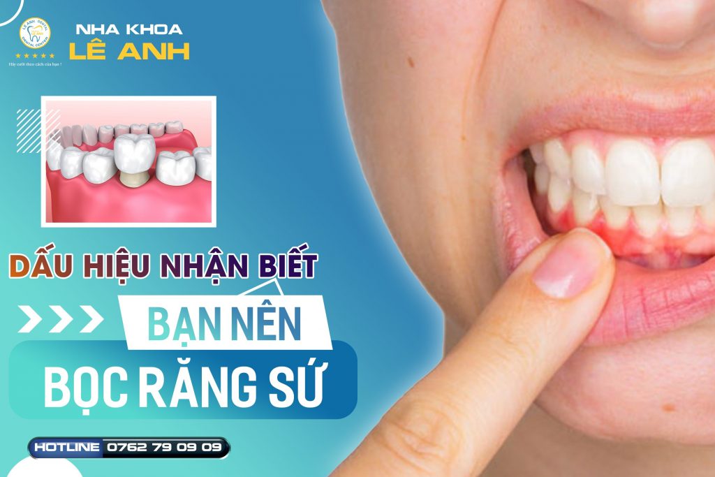 bọc răng sứ nguyên hàm