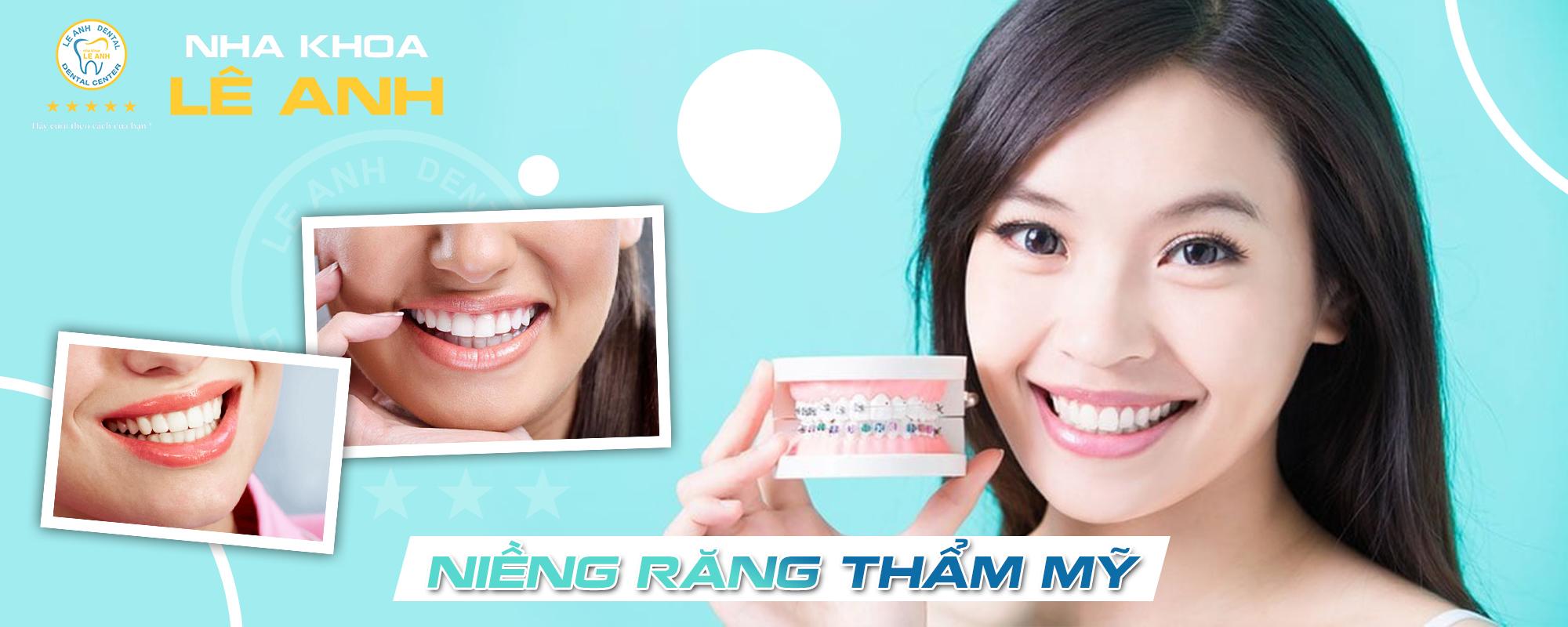 phương pháp niềng răng