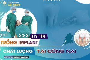 cấy ghép implant 01