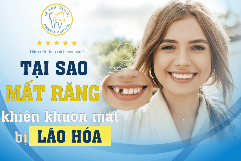 tại sao mất răng khiến khuôn mặt bị lão hóa