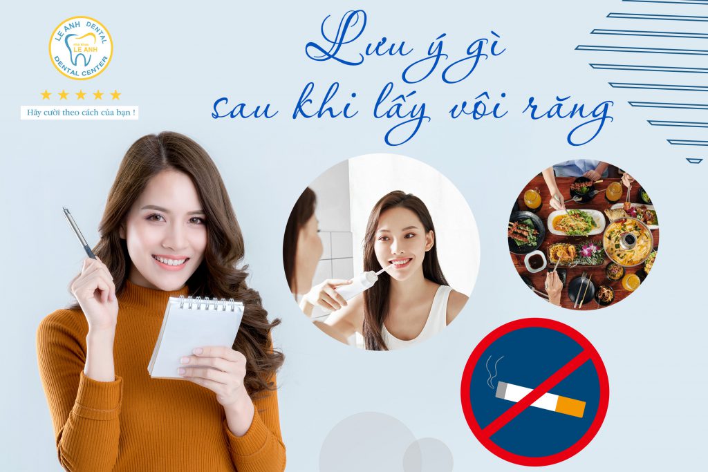 4. Lưu ý gì sau khi lấy vôi răng