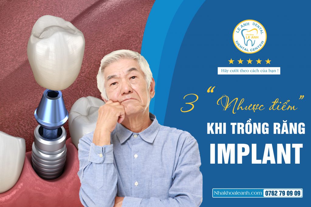 03 “NHƯỢC ĐIỂM” KHI TRỒNG RĂNG IMPLANT