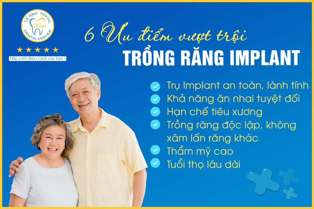 06 ƯU ĐIỂM VƯỢT TRỘI KHI TRỒNG RĂNG IMPLANT