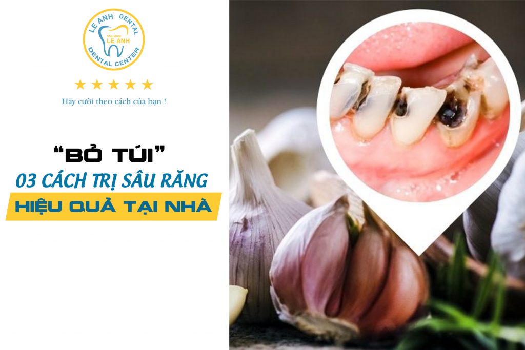 “BỎ TÚI” 03 CÁCH TRỊ SÂU RĂNG HIỆU QUẢ TẠI NHÀ