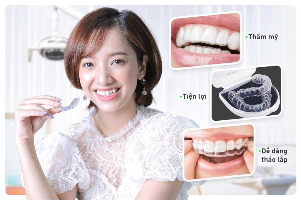 Niềng răng với khay trong suốt Invisalign