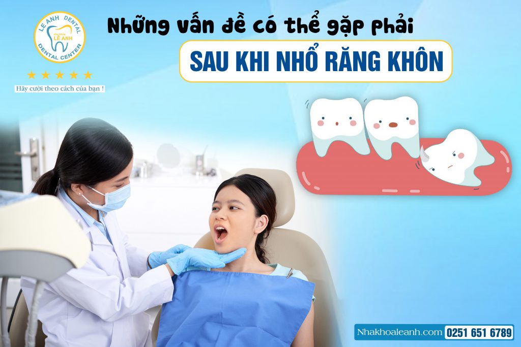 2. Những vấn đề có thể gặp phải sau khi nhổ răng khôn