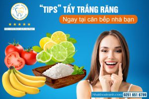 “TIPS” TẨY TRẮNG RĂNG NGAY TẠI CĂN BẾP NHÀ BẠN