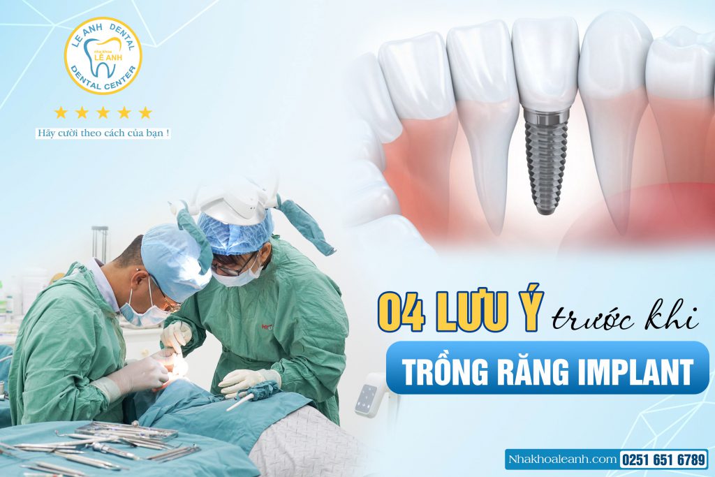 LƯU Ý TRƯỚC KHI TRỒNG RĂNG IMPLANT