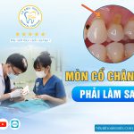 BỊ MÒN CỔ CHÂN RĂNG PHẢI LÀM SAO ?
