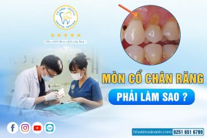 BỊ MÒN CỔ CHÂN RĂNG PHẢI LÀM SAO ?