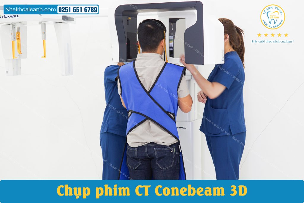 CHỤP PHIM CT CONEBEAM 3D