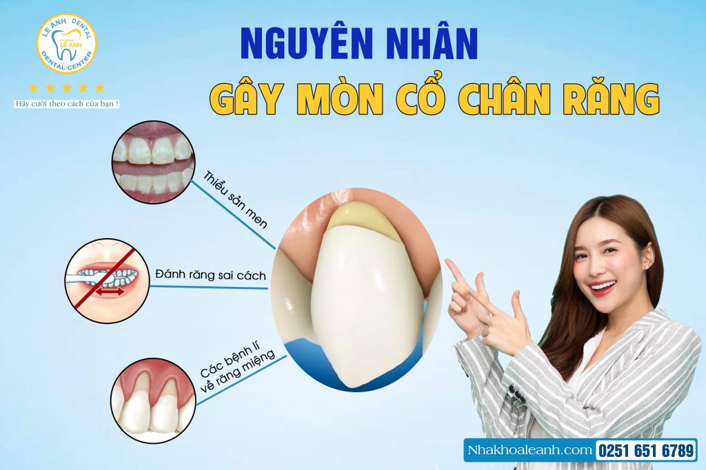 2. Nguyên nhân gây mòn cổ chân răng