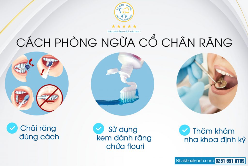 4. Cách phòng ngừa mòn cổ chân răng